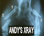 Xrays